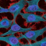 La estrategia de teragnosis contra el cáncer avanza en México hacia etapas tempranas